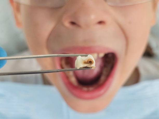 Urgent Tooth Repair in NJ