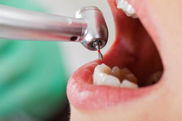 Best Root Canal Emergency Dentist  in Elmwood Park, NJ
